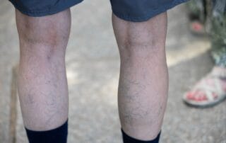 Seguro Médicos para estudiantes y extranjeros