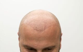 Medico de Seguro de Salud